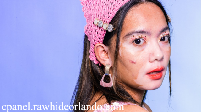 Cara Mengatasi Putih-Putih di Wajah Penyebab dan Solusinya