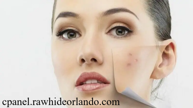 Cara Efektif Hilangkan Noda Hitam di Wajah Panduan Lengkap